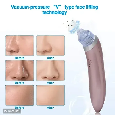 4 in 1 Rechargeable Device ! Multi-function Blackhead Remover and Whitehead Remover Device - Acne Pore Cleaner Vacuum Suction Tool for Men and Women Gently pull dirt and oil out of your skin facial-thumb2