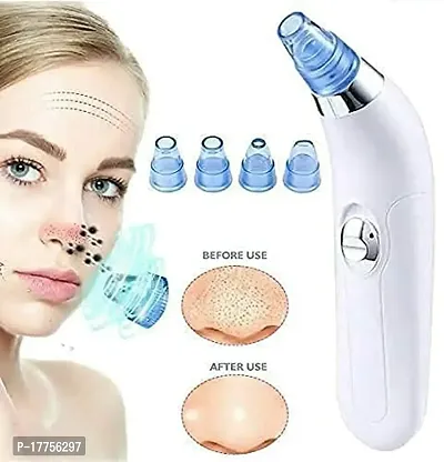 4 in 1 Multi-function Blackhead Remover Tool | Electric Derma suction Machine for Whitehead | Acne Pimple Pore Cleaner Vacuum tools | Facial Cleanser Device for Face, Nose and Skin Care-thumb4