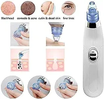 4 in 1 Multi-function Blackhead Remover Tool | Electric Derma suction Machine for Whitehead | Acne Pimple Pore Cleaner Vacuum tools | Facial Cleanser Device for Face, Nose and Skin Care-thumb4
