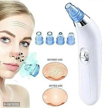4 in 1 Multi-function Blackhead Remover Tool | Electric Derma suction Machine for Whitehead | Acne Pimple Pore Cleaner Vacuum tools | Facial Cleanser Device for Face, Nose and Skin Care ,DERMA SUCTION