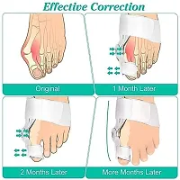 Toe Straightener Bunion Corrector Splint with Toe Fracture Support and Foot Support for Pain Relief-thumb2