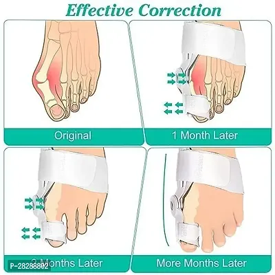 Toe Straightener Bunion Corrector Splint with Toe Fracture Support and Foot Support for Pain Relief-thumb3