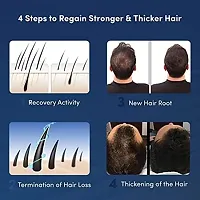 Hair and Beard Growth |Beard Activator |540 Titanium Microneedling Roller-thumb4