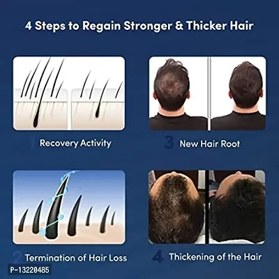 Hair and Beard Growth |Beard Activator |540 Titanium Microneedling Roller-thumb5