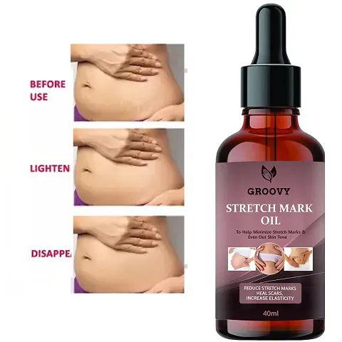 Groovy Stretch Mark Oil