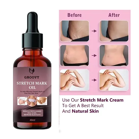 Groovy Stretch Mark Oil