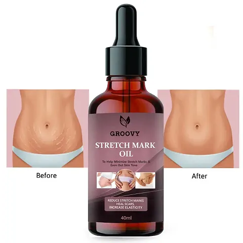 Groovy Stretch Mark Oil