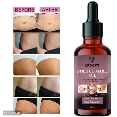 Natural Stretchmarks Removal Oil