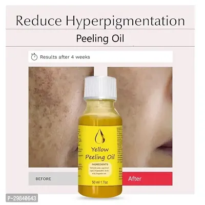 Peeling Oil for Yellow Dark Skin, Extra Strength, Exfoliating Peeling Solution 50 ml-thumb2