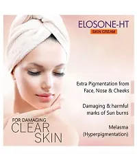 Elosone -HT  Day  Night Soft  Smooth Skin Cream 15 gm (Pack Of-4)-thumb1