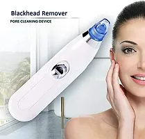 Facial Cleanser Device 4 in 1 Multi-function Blackhead Remover Tool(PACK OF 1)-thumb1