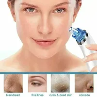 Derma Suction Blackhead Remover Vacuum Pimple Sucker Tool-thumb3