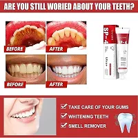 Oral Care Teeth Whitening Toothpaste, 50gm-thumb1