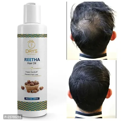 Reetha Onion Shikakai Bhringraj Amla Hair Oil For Men And Women 10% Natural Oils And Herbs Promotes Hair Growth And Controls Hair Fall 10 Ml