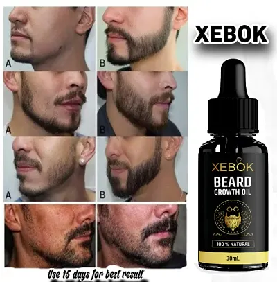 Best Selling All Type Skin Beard Oil