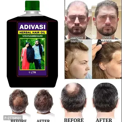 Adivasi Herbal Hair Oil 1 Ltr-thumb0