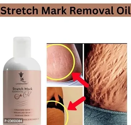 Present High Quality Streach Mark Oil For Stretch Mark Remover Oil | Pet Ke Stretch Mitaye | Dag Hata Ne Vala Oil |(100Ml) Pack Of 1-thumb0