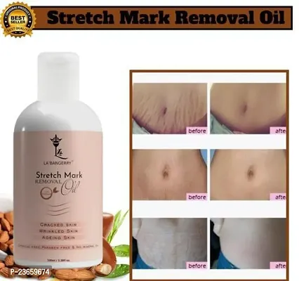 Stretch Mark For Pregenent Women, Pregnent Lady Stretch Mark Oil, Stretch Mark Removal Oil,Stretch Mark Remover Oil, Stretch Mark Cream Pet Ke Stretch Mitaye , Dagh Hata Ne Vala Tel ,Purane Aor Jidii Sterch Hatane Vala Tel-100Ml |Pack Of 1