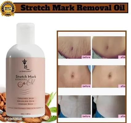 Stretch Mark For Pregenent Women, Pregnent Lady Stretch Mark Oil, Stretch Mark Removal Oil,Stretch Mark Remover Oil, Stretch Mark Cream Pet Ke Stretch Mitaye , Dagh Hata Ne Vala Tel ,Purane Aor Jidii Sterch Hatane Vala Tel-100Ml |Pack Of 1-thumb0