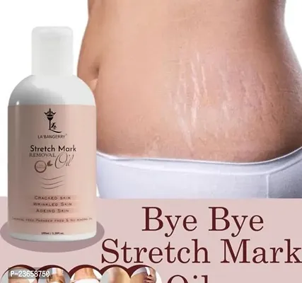 Stretch Mark Oil, Stretch Mark Cream, Pregnancy Stretch Marks Removal Oil, Breast Stretch Marks Removal, Delivery Stretch Marks Removal Oil Old Stretch Mark Removal 100Ml Pack Of 1