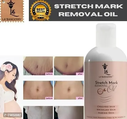 Stretch Mark For Pregenent Women, Pregnent Lady Stretch Mark Oil, Stretch Mark Removal Oil,Stretch Mark Remover Oil, Stretch Mark Cream Pet Ke Stretch Mitaye , Dagh Hata Ne Vala Tel ,Purane Aor Jidii Sterch Hatane Vala Tel-100Ml |Pack Of 1-thumb0