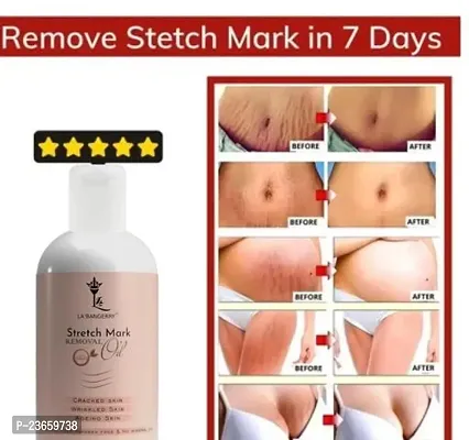 Stretch Mark For Pregenent Women, Pregnent Lady Stretch Mark Oil, Stretch Mark Removal Oil,Stretch Mark Remover Oil, Stretch Mark Cream Pet Ke Stretch Mitaye , Dagh Hata Ne Vala Tel ,Purane Aor Jidii Sterch Hatane Vala Tel-100Ml |Pack Of 1-thumb0