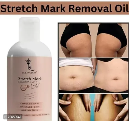 Stretch Mark For Pregenent Women, Pregnent Lady Stretch Mark Oil, Stretch Mark Removal Oil,Stretch Mark Remover Oil, Stretch Mark Cream Pet Ke Stretch Mitaye , Dagh Hata Ne Vala Tel ,Purane Aor Jidii Sterch Hatane Vala Tel-100Ml |Pack Of 1-thumb0