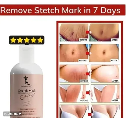 Stretch Mark Oil, Stretch Mark Cream, Pregnancy Stretch Marks Removal Oil, Breast Stretch Marks Removal, Delivery Stretch Marks Removal Oil Old Stretch Mark Removal 100Ml Pack Of 1-thumb0