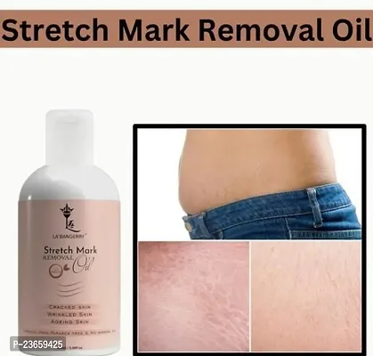 Present Repair Stretch Marks Removal - Natural Heal Pregnancy Breast, Hip, Legs, Mark Oil, Purane Aor Jidii Sterch Hatane Vala Tel, Pure Sarir Ka Stretch Dur Krne Ka Tel, Bio Oil, Kamar Ka Stretch Dur Kre, Pet Ka Stretch Dur Krnre Ka Tale-100Ml(Pack Of 1)-thumb0