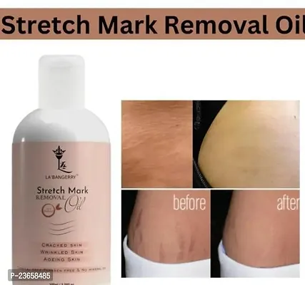 Stretch Marks Oil Natural Stretch Oil With Almond, Olive And Jojoba Oils, For Scars And Stretchmarks 100 Ml)-thumb0