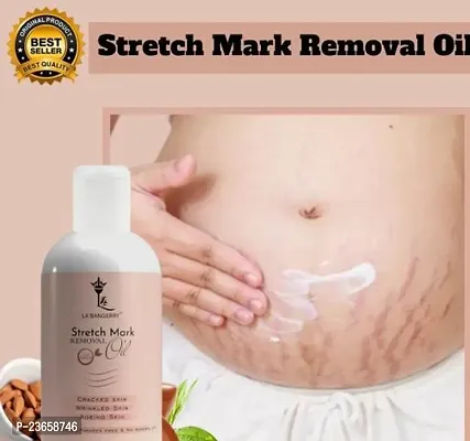 Present Premium Quality Streatch Mark Oil | Remove Stretch Mark | Body Ka Stretch Dur Karne Vala Oil | Best Oil For Strech Mark | Ageing Skin | (100Ml) Pack Of 1