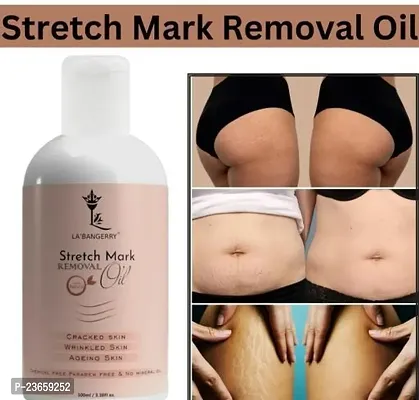 Stretch Marks Oil Natural Stretch Oil With Almond, Olive And Jojoba Oils, For Scars And Stretchmarks 100 Ml)-thumb0