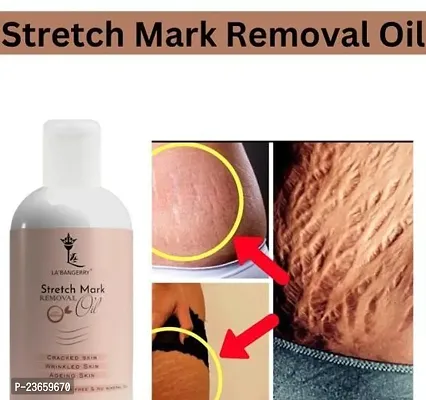 Present Repair Stretch Marks Removal - Natural Heal Pregnancy Breast, Hip, Legs, Mark Oil, Purane Aor Jidii Sterch Hatane Vala Tel, Pure Sarir Ka Stretch Dur Krne Ka Tel, Bio Oil, Kamar Ka Stretch Dur Kre, Pet Ka Stretch Dur Krnre Ka Tale-100Ml(Pack Of 1)