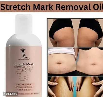 Present Top Branded Repair Stretch Marks Removal | Natural Heal Pregnancy Breast, Hip, Legs, Mark Oil | Cracked Skin | Wrinkled Skin | Ageing Skin | (100Ml) Pack Of 1