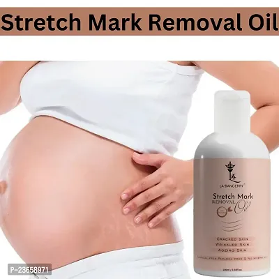 Stretch Mark For Pregenent Women, Pregnent Lady Stretch Mark Oil, Stretch Mark Removal Oil,Stretch Mark Remover Oil, Stretch Mark Cream Pet Ke Stretch Mitaye , Dagh Hata Ne Vala Tel ,Purane Aor Jidii Sterch Hatane Vala Tel-100Ml |Pack Of 1