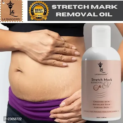 Present High Quality Streach Mark Oil For Stretch Mark Remover Oil | Pet Ke Stretch Mitaye | Dag Hata Ne Vala Oil |(100Ml) Pack Of 1