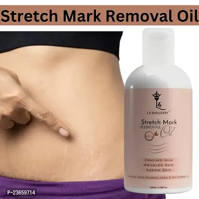 Pregnancy And Maternity Stretch Marks Removal Cream Stretch Marks And Scars Creams For Women (100 Ml) Pack Of 1