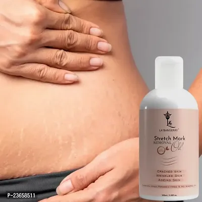 Present Top Branded Repair Stretch Marks Removal | Natural Heal Pregnancy Breast, Hip, Legs, Mark Oil | Cracked Skin | Wrinkled Skin | Ageing Skin | (100Ml) Pack Of 1-thumb0