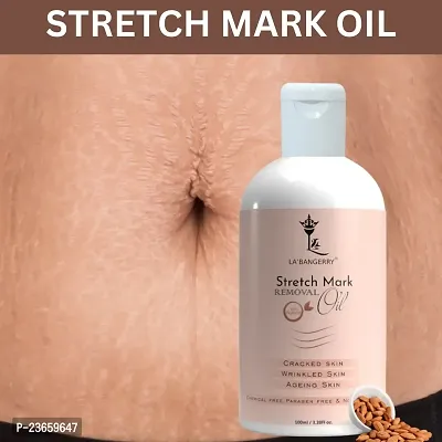 Stretch Mark For Pregenent Women, Pregnent Lady Stretch Mark Oil, Stretch Mark Removal Oil,Stretch Mark Remover Oil, Stretch Mark Cream Pet Ke Stretch Mitaye , Dagh Hata Ne Vala Tel ,Purane Aor Jidii Sterch Hatane Vala Tel-100Ml |Pack Of 1-thumb0