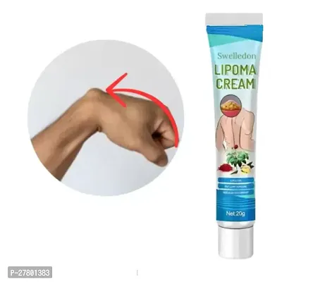 Lipoma Removal Herbal Cream for Men and Women Lipoma Easy to Use  (20 g)-thumb0