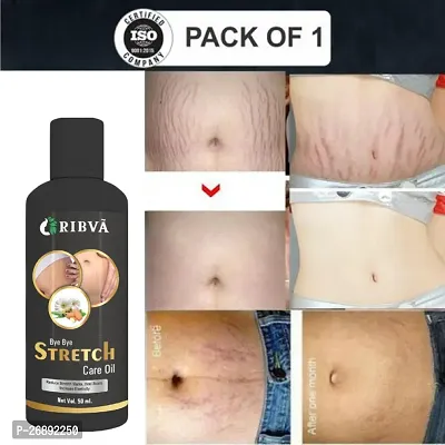 RIBVA present Stretch Marks Removal Oil - Natural Heal Pregnancy, Hip, Legs, Mark oil 50 ml pack1