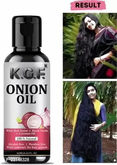 Kgf Onion Hair Oil For Hair Loss And Anti Dandruff Hair Oil (60 Ml)