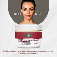 SABATES Pimple Acne Cream For Acne Scars  Marks Cream || Acne Scars Corrector || Formulated Specially to Address Scars  Marks || Suitable For All Skin Types | Pimple Cream For Girls-thumb2