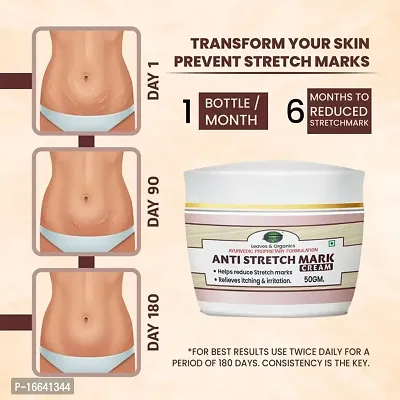 SABATES Anti Stretch Marks Cream | Removes Pregnancy stretch marks, Scar removal  Moisturizing Cream, Stretch mark remover for Stomach, thighs  Body (No Side Effects)-thumb2