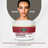 SABATES Anti Acne, Pimple  Scar Removal Cream | Glowing Skin, Oil-Free Repairing Face Moisturizer Reduce Redness  Dryness | Pimple Cream For Girls-thumb2