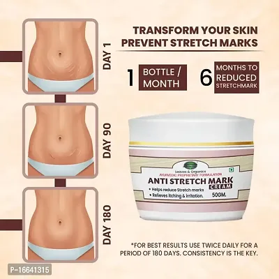 SABATES Anti Stretch Marks Cream | Reducing Stretch Marks  Scars During Pregnancy or Weight Loss, Scar removal  Stretch mark remover for Stomach, thighs  all body parts (No Side Effects)-thumb2