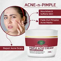 SABATES Pimple Acne Moisturizing Gel Cream For Acne Free Skin | Glowing Skin, Oil-Free Repairing Face Moisturizer - Unisex (Zero Side-Effect)-thumb4
