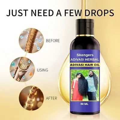 Anti Dandruff Hair Oil  Herbal Hair Oils  Hair Growth Oil