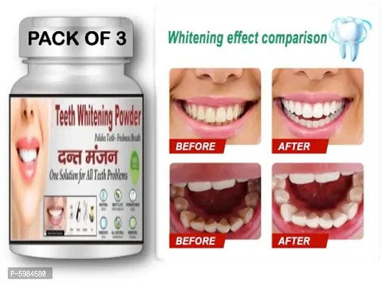 TEETH WHITWNING POWDER GUARANTEED RESULT IN 7 DAYS. (PACK OF 3)