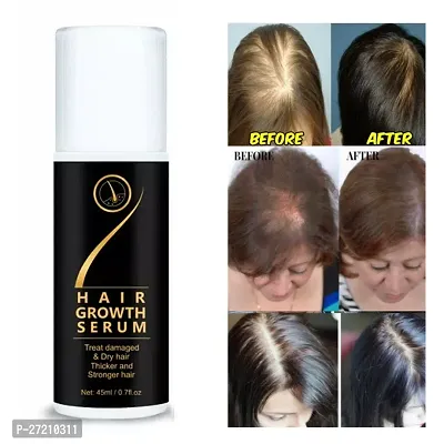 Hair Growth Serum For Men And Women-thumb3
